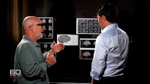 Doomscrolling habits giving lasting brain rot effects | Digital dementia fears explored in new br…