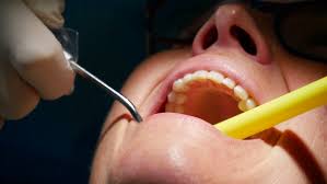 Patients of retired Sydney dentist advised to test for bloodborne viruses | Sydney dentist’s pati…