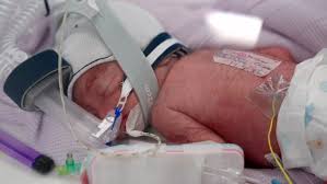 Quadruplets born in Brisbane ‘one of the rarest births in the world’ | Queensland mum gives birth…